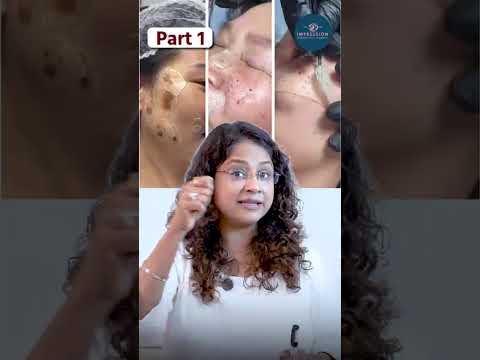 PPET - Permanent Pigmentation removal treatment.What is the reality?Is it safe? Understand the truth