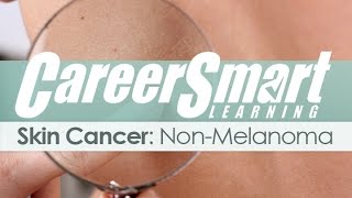 Skin Cancer: Non-Melanoma – Nurse – Case Manager – CRC – WC CA