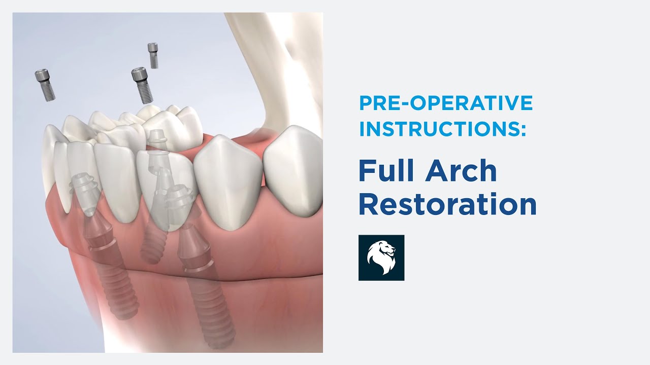 Pre-Operative Instructions for Full-Arch Restoration in New Hudson, MI