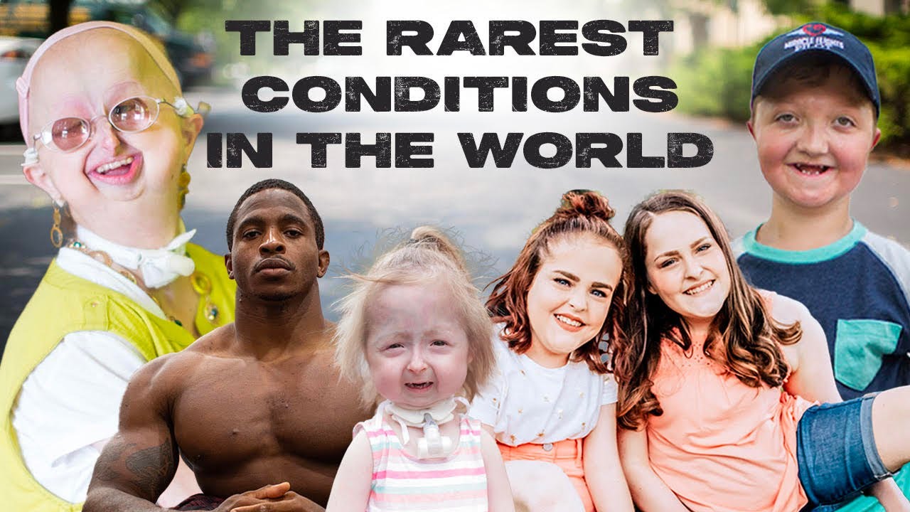 10 Of The Rarest Conditions In The World | BORN DIFFERENT