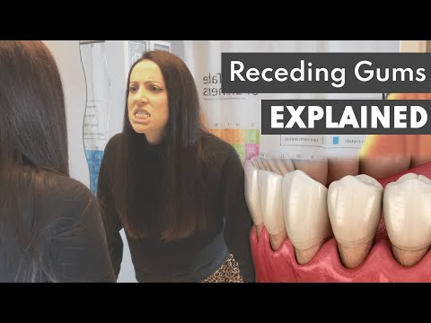 Vídeo: Receding Gums Treatment: O Que Você Deve Saber
