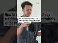 New AI powered portable X-ray machines helps treat tuberculosis in the Philippines