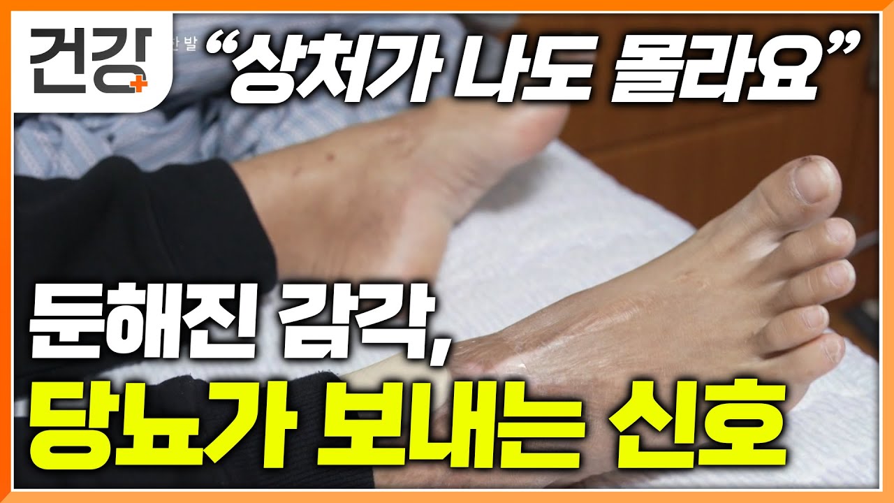 한번 손상되면 회복이 어렵고, 완치 약도 없는 말초신경병증. 어떤 증상이 있을 때 의심해 봐야 할까?│당뇨│명의│#EBS건강