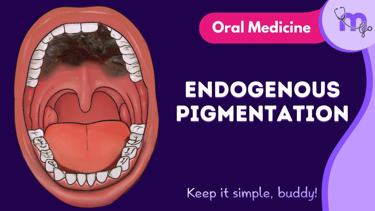 Endogenous Pigmented Lesions of the Oral Cavity