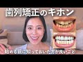 【歯列矯正】やりたいと思ってる人に観て欲しい!マウスピース矯正のキホン
