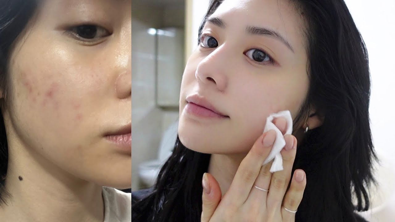 광고❌ 데이 앤 나잇 스킨케어 루틴 !!🦋 트러블 관리템🤍I 데일리 메이크업ㅣ메이 메이크업