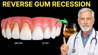 Asia Oldest Doctors Warn: Just Use These 2 Oils Every Night and Regrow Your Gums