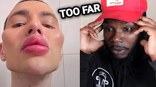 Looksmaxxing Hit A Breaking Point… Now People Are Regretting It