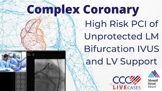 High Risk PCI of Unprotected LM Bifurcation IVUS and LV Support - January 16, 2018