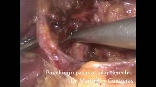 Arturo Martínez Contreras-12