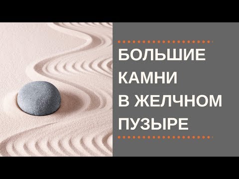 Большие Камни в Желчном.  Больше 2 см.  Что делать?