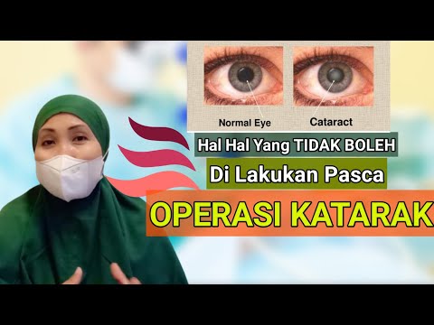 PERAWATAN SETELAH  OPERASI KATARAK - EDUKASI PERAWATAN MATA SETELAH OPERASI KATARAK