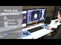 Clinical Trial: Squamous Cell Cancers of the Head & Neck - Robert Chin, MD | UCLA Radiation Oncology