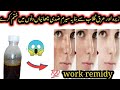 Made With Cumin&amp;Rose Water, This Serum Removes Stubborn Dark Spots &amp;  Blemishes In Days|Useful Tips