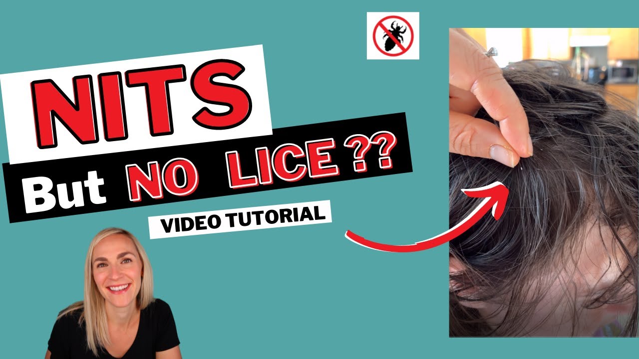 Nits But No Lice Tutorial