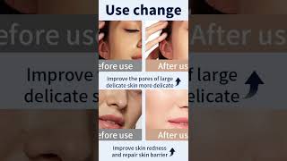 7 Color LED Face Mask with Neck Wireless Portable Red Light Therapy for Anti-Aging