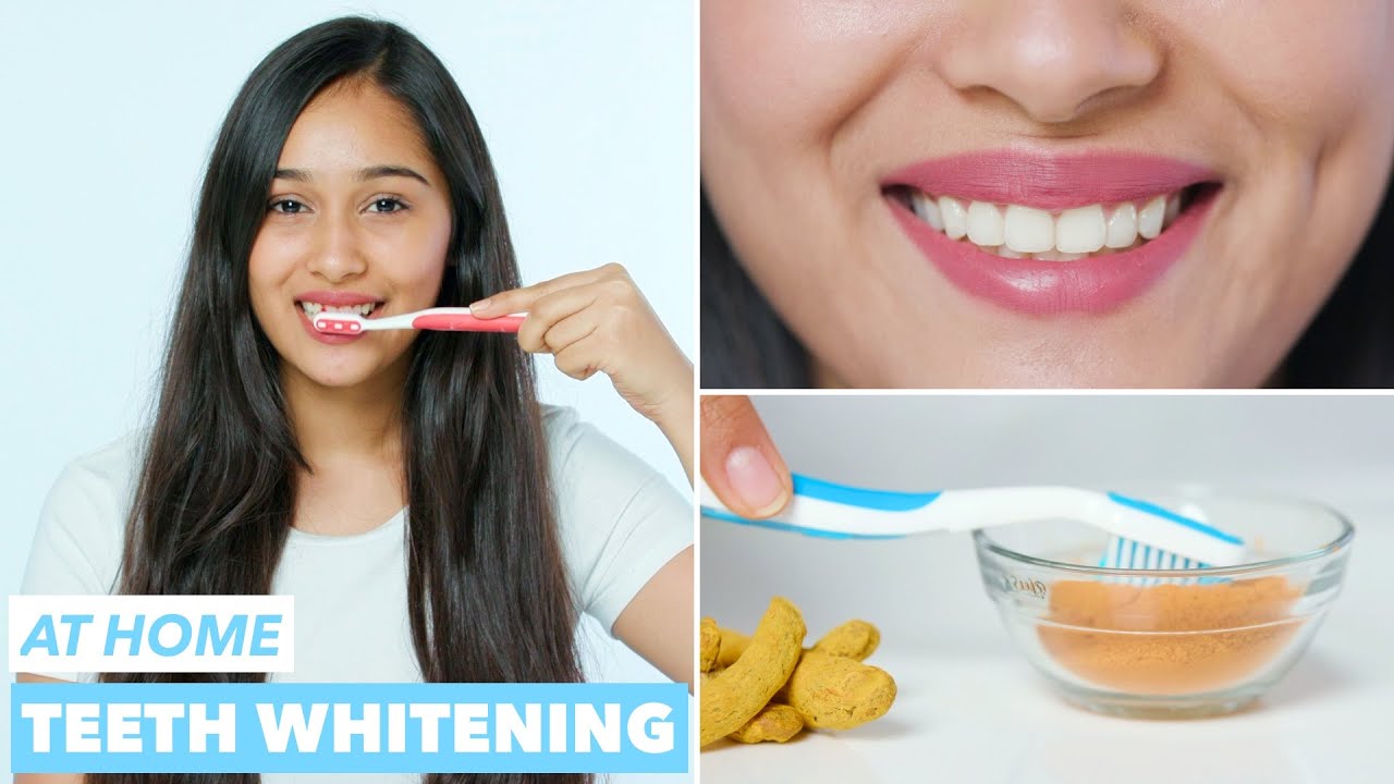How can you make your teeth whiter