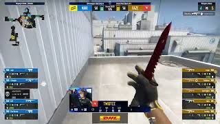 Twistzz Breaks Navis Backs