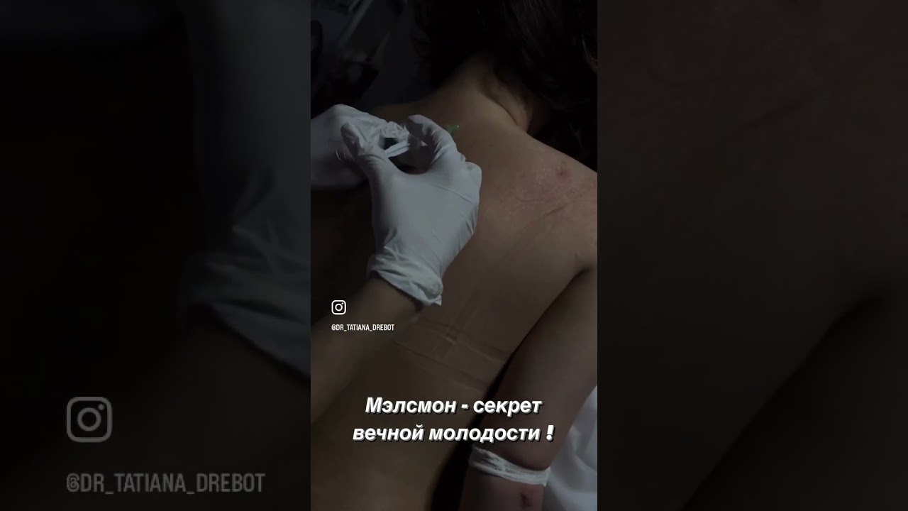 Плацентарный препарат Мэлсмон.