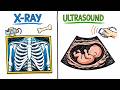 Difference Between X-Ray vs Ultrasound Explained