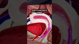 Period cramps explained! #shorts