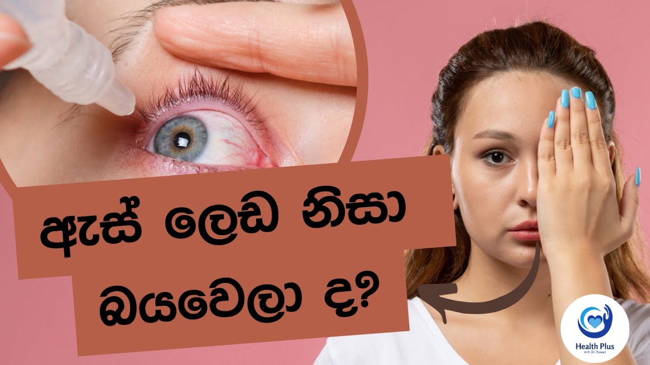 මේ දිනවල වේගයෙන් පැතිරෙන ඇස් ලෙඩ (Pink eye) ගැන ඔබ දැනුවත් ද?