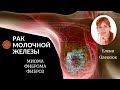 Рак груди. Миома. Фиброма. Фиброз. Рекомендации доктора аюрведы.