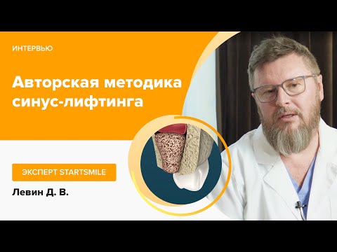 Синус-лифтинг без боли и осложнений | Стоматология Доктора Левина