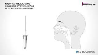 Sd Biosensor Covid-19 Antigen Rapid Kit Test