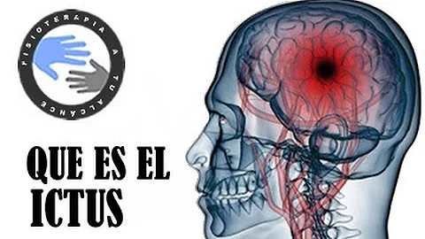 ¿Qué le ocurre a su cerebro tras un mini-ictus?