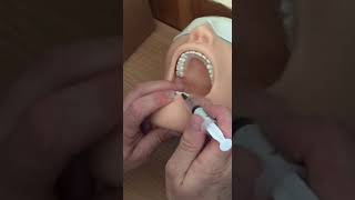 Анестезии в стоматологии , OSCE-1