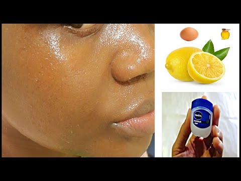 FOREVER YOUNG!!Using Vaseline, Lemon,Aleo vera, Egg white & Honey /Forever  16 years Old!!BABY FACE