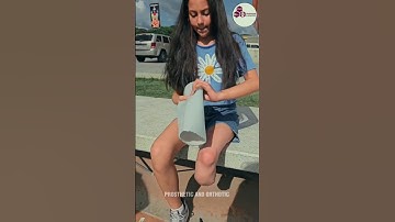 Unstoppable Spirit  🦵Little Girl with Prosthetic Leg Living Life to the Fullest #limbs #everygirl