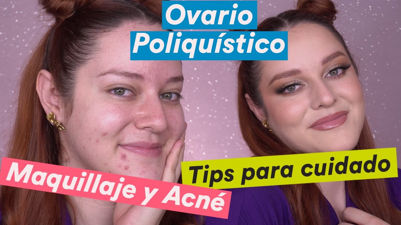 Cómo cubrir ACNÉ con maquillaje - Pamela Segura