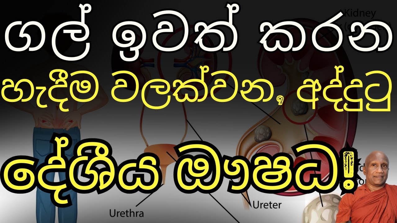 ගල් ඉවත් කරන, හැදීම වලක්වන, අද්දුටු දේශීය ඖෂධ!