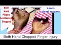 Learn Hand Surgery || Both Hand Fingers accidentally chopped