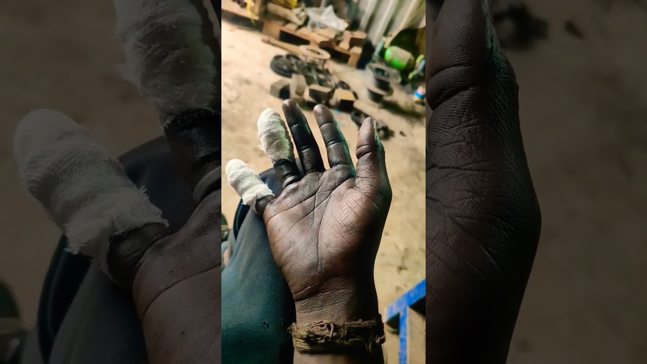 Accident 🥲🥴😦😧 