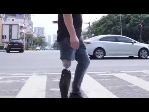 Can Above Knee Amputees Walk Normally Again?