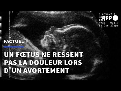 Vidéo: Avortement à Long Terme
