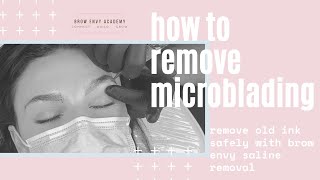 How To: Remove Microblading With Saline Tattoo Removal