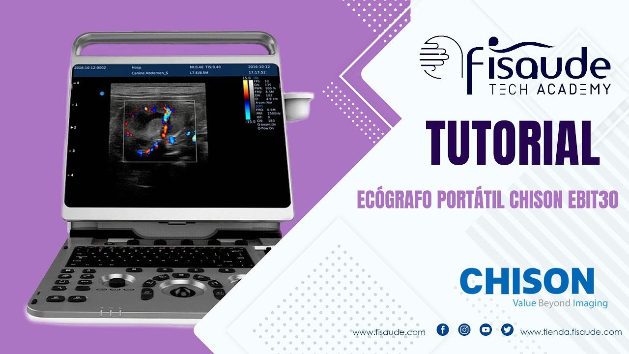 Tutorial ecógrafo Chison Ebit 30