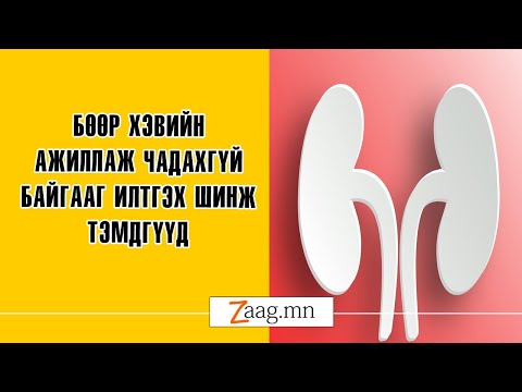 Видео: Хүчний мэдрэлийн гэмтэл ямар шинж тэмдэг илэрдэг вэ?