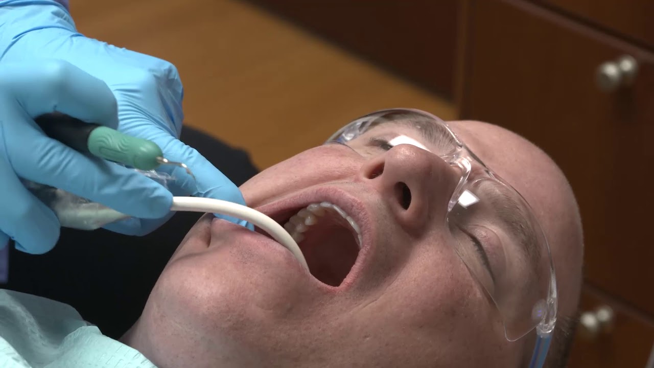 Purevac HVE System with Mirror Tips and Hose Adapter — User Adaptation