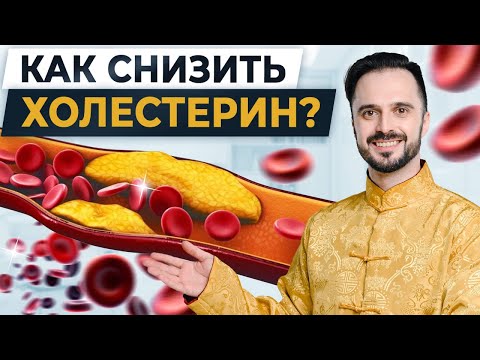 КАК снизить ХОЛЕСТЕРИН: простые способы. Нужна ли ДИЕТА для СНИЖЕНИЯ уровня холестерина в крови?