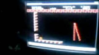 super mario frustration Extreme core LG Part 2