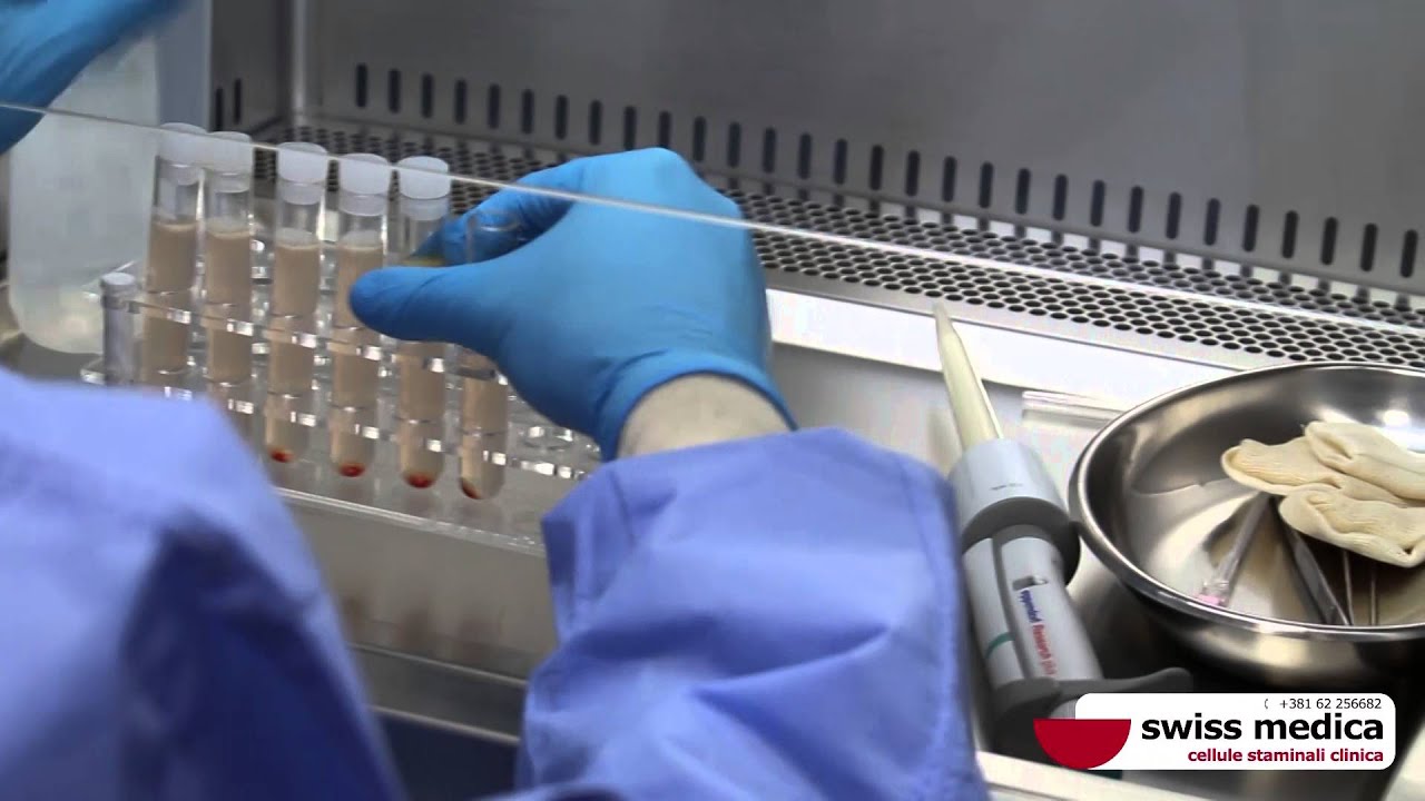 Trattamento con cellule staminali