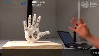 Myoelectric control of a 3D printed prosthetic hand