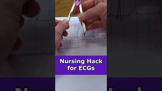 Nursing Hack for ECG Interpretation Calipers #shorts | Nurse Hacks Resimi