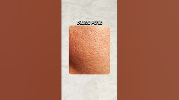 STOP wasting your money on HydraFacial!