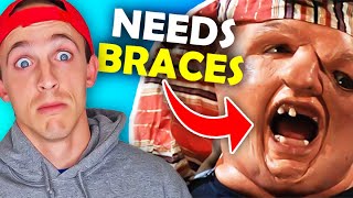 How To Know If You NEED Braces...SURPRISING FACTS you may not know..